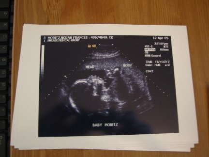 Ultrasound - April 2005